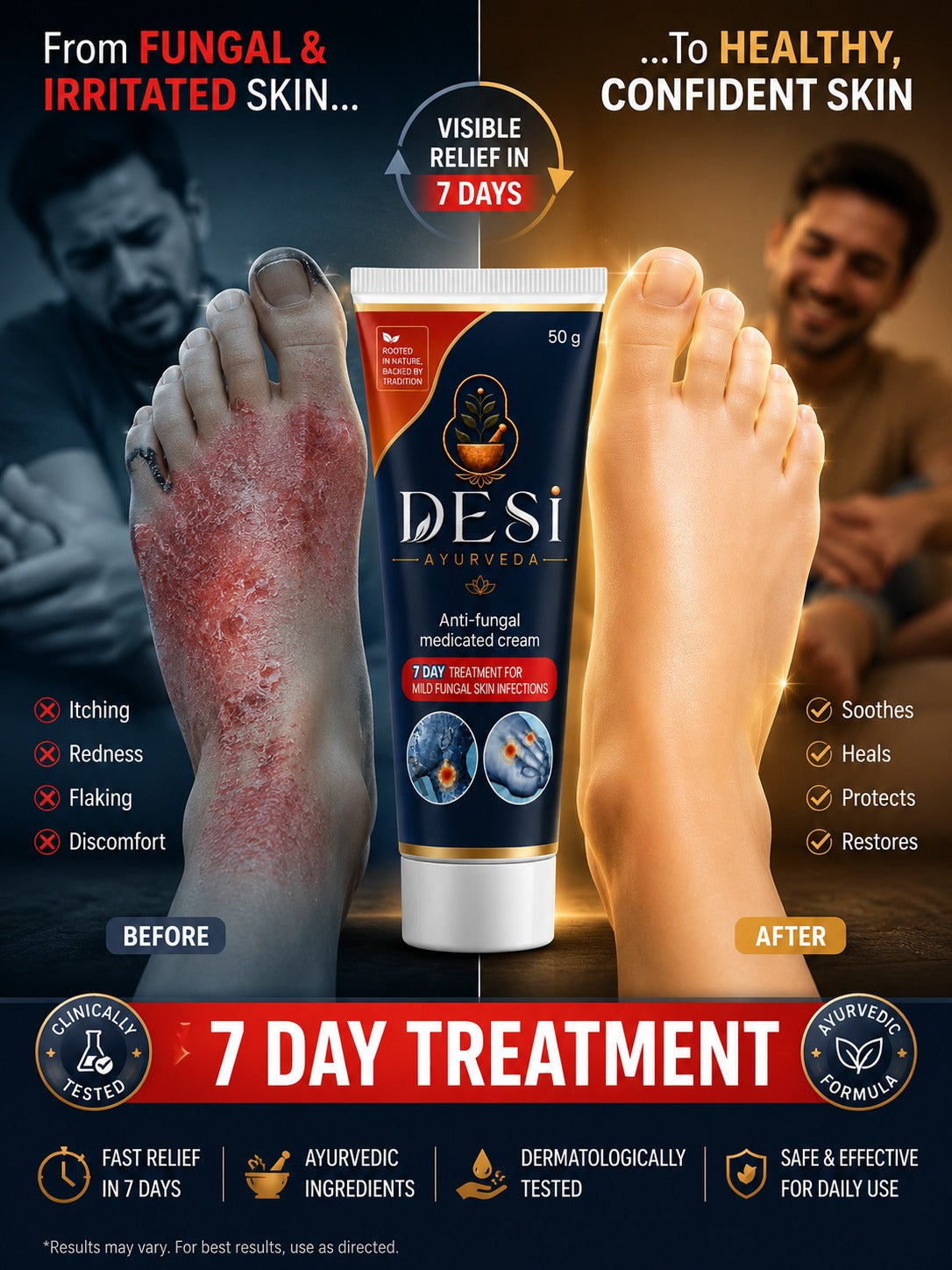 DESI Ayurveda Anti-Fungal Medicated Cream – 50g